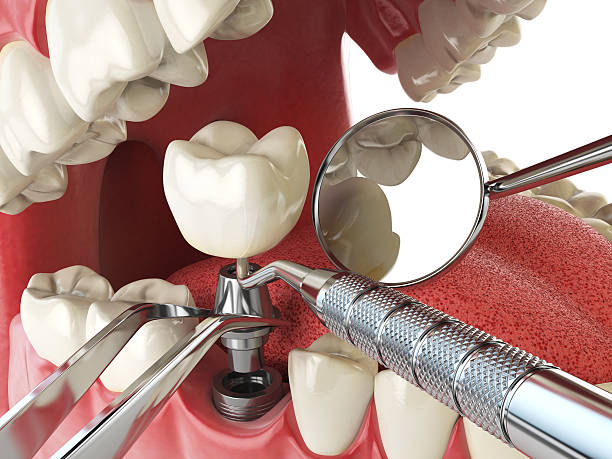 Best Same-Day Emergency Dental Services in Renova, MS